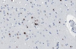 phospho-Tau (Ser235), Mouse anti-Human, Mouse, Clone: RN235, Millipore Sigma 25 &mu;g | Buy Online | MilliporeSigma | Fisher Scientific